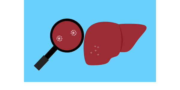 BBP - Blood Borne Pathogen - Diseases